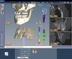 E4D Dentist Tarama, Tasarım, Frezleme, CAD/CAM Cihazı